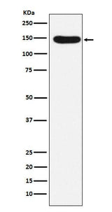 Anti-Desmoglein 3 Rabbit Monoclonal Antibody Boster Bio