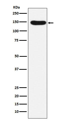 Anti-Desmoglein 3 Rabbit Monoclonal Antibody Boster Bio