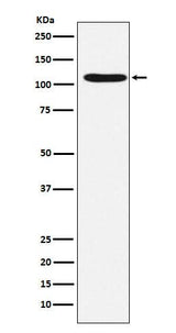 Anti-HIRA Rabbit Monoclonal Antibody Boster Bio