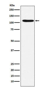 Anti-HIRA Rabbit Monoclonal Antibody Boster Bio