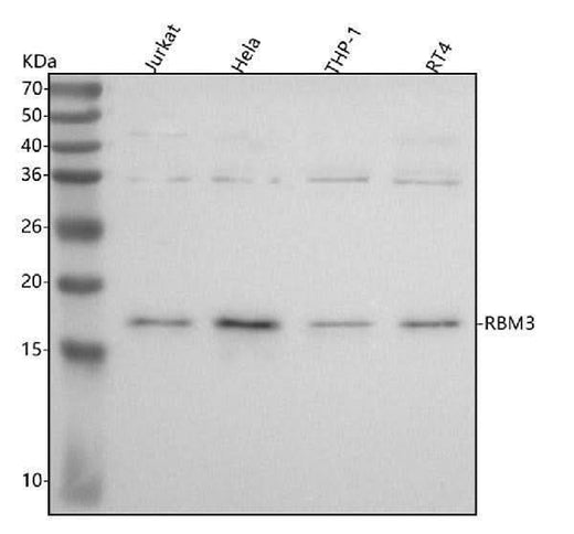 Anti-RBM3 Rabbit Monoclonal Antibody Boster Bio