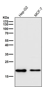 Anti-Cripto1 Rabbit Monoclonal Antibody Boster Bio
