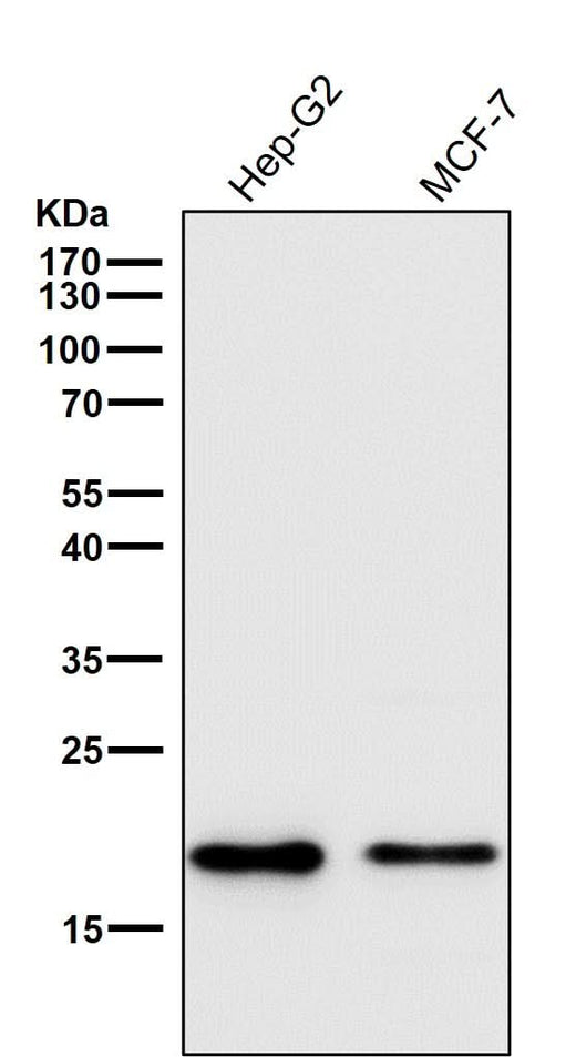 Anti-Cripto1 Rabbit Monoclonal Antibody Boster Bio