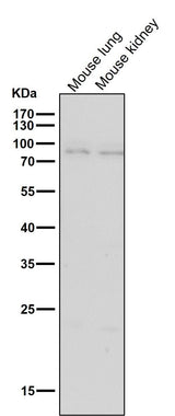 Anti-BDKRB2 Monoclonal Antibody Boster Bio