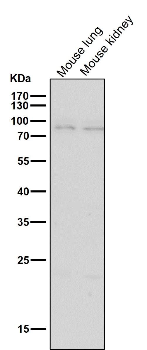 Anti-BDKRB2 Monoclonal Antibody Boster Bio