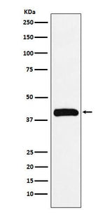 Anti-Bub3 Rabbit Monoclonal Antibody Boster Bio