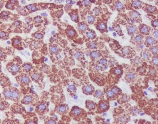 Anti-Catalase Rabbit Monoclonal Antibody Boster Bio
