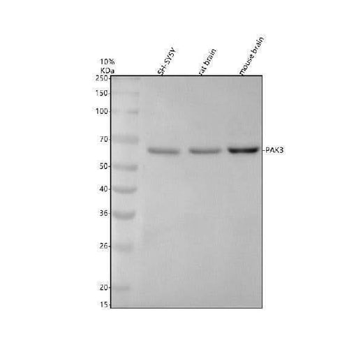 Anti-PAK3 Rabbit Monoclonal Antibody Boster Bio