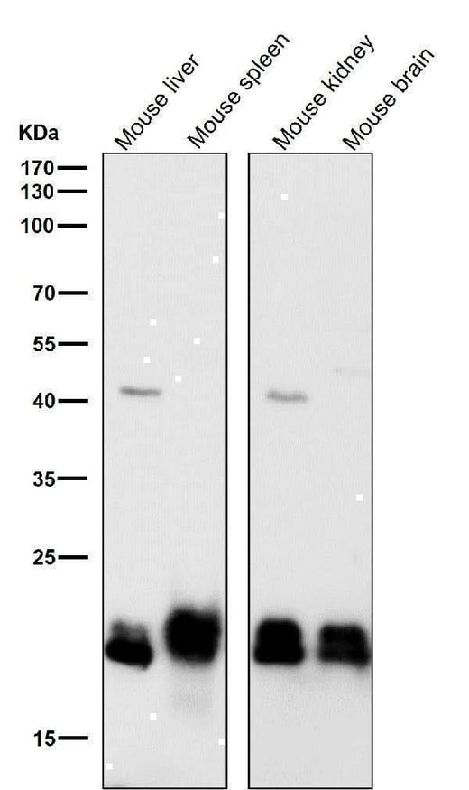Anti-SRSF3 Rabbit Monoclonal Antibody Boster Bio