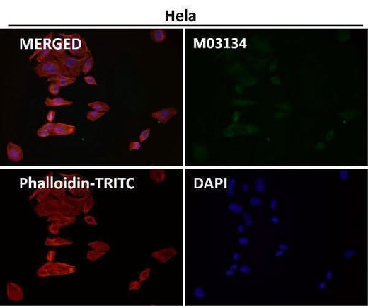 Anti-Clathrin heavy chain Rabbit Monoclonal Antibody Boster Bio