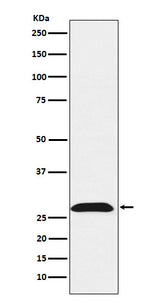 Anti-RhoGDI Rabbit Monoclonal Antibody Boster Bio