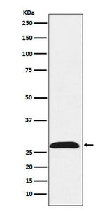 Anti-RhoGDI Rabbit Monoclonal Antibody Boster Bio