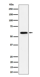 Anti-PRPF31 Rabbit Monoclonal Antibody Boster Bio