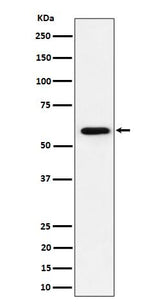 Anti-PRPF31 Rabbit Monoclonal Antibody Boster Bio