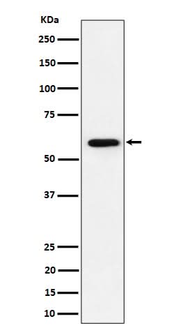 Anti-PRPF31 Rabbit Monoclonal Antibody Boster Bio