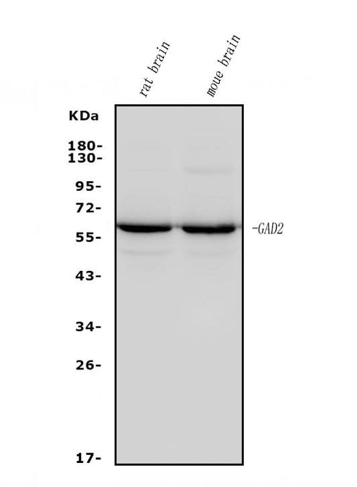 Anti-GAD65/GAD2 Antibody Picoband® (monoclonal, 4E12 Boster Bio