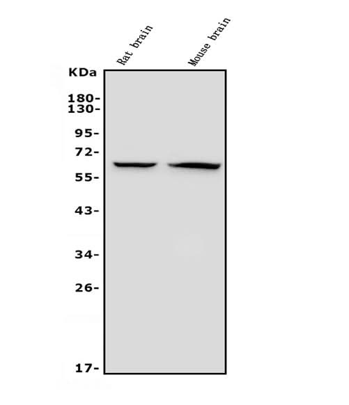 Anti-GAD65/GAD2 Antibody Picoband® (monoclonal, 7G2 Boster Bio