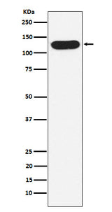 Anti-Nicastrin Rabbit Monoclonal Antibody Boster Bio