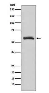 Anti-Muscarinic Acetylcholine Receptor M3 Rabbit Monoclonal Antibody Boster Bio
