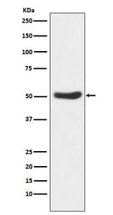 Anti-GSK3 alpha Rabbit Monoclonal Antibody Boster Bio