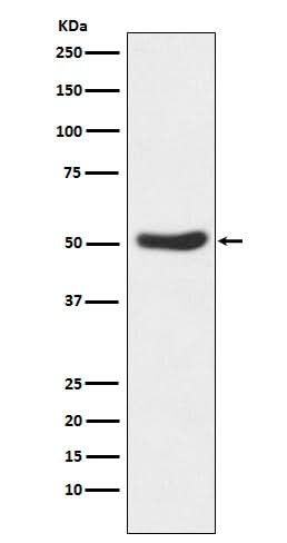 Anti-GSK3 alpha Rabbit Monoclonal Antibody Boster Bio