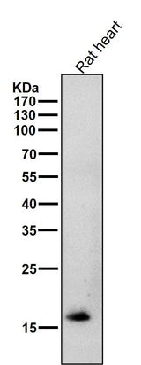 Anti-Cardiac Troponin C Rabbit Monoclonal Antibody Boster Bio