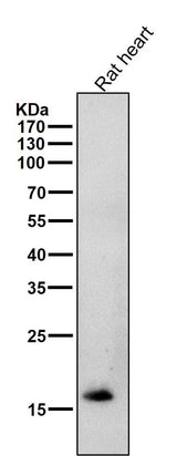 Anti-Cardiac Troponin C Rabbit Monoclonal Antibody Boster Bio