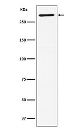 Anti-EDD Rabbit Monoclonal Antibody Boster Bio