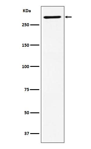 Anti-EDD Rabbit Monoclonal Antibody Boster Bio