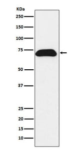 Anti-PDZK1 Rabbit Monoclonal Antibody Boster Bio
