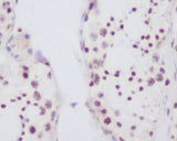 Anti-Fibrillarin FBL Rabbit Monoclonal Antibody Boster Bio