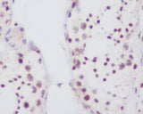 Anti-Fibrillarin FBL Rabbit Monoclonal Antibody Boster Bio