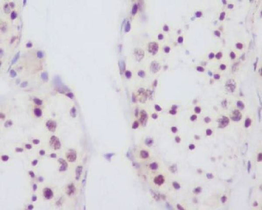 Anti-Fibrillarin FBL Rabbit Monoclonal Antibody Boster Bio