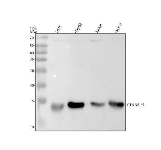 Anti-CTNNBIP1 Rabbit Monoclonal Antibody Boster Bio