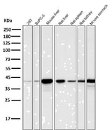 Anti-Glutamine Synthetase GLUL Rabbit Monoclonal Antibody Boster Bio