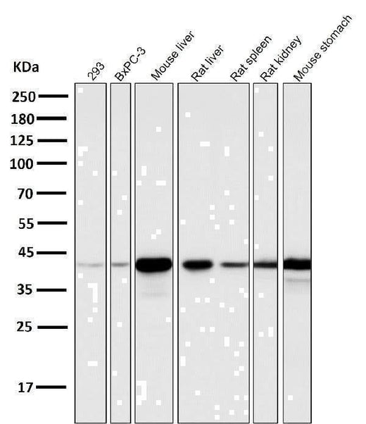 Anti-Glutamine Synthetase GLUL Rabbit Monoclonal Antibody Boster Bio