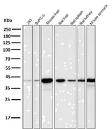 Anti-Glutamine Synthetase GLUL Rabbit Monoclonal Antibody Boster Bio