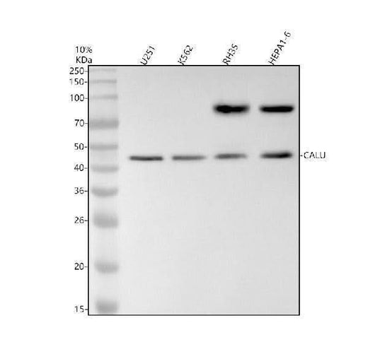 Anti-Calumenin Rabbit Monoclonal Antibody Boster Bio