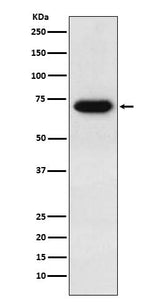 Anti-CD39 Rabbit Monoclonal Antibody Boster Bio