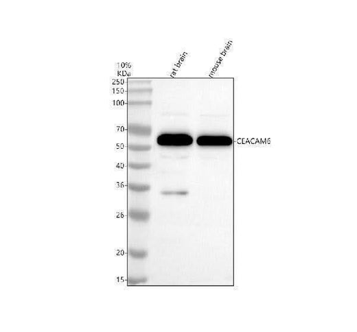 Anti-CEACAM6 Rabbit Monoclonal Antibody Boster Bio