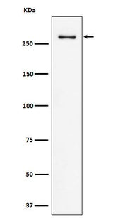 Anti-CHD3 Rabbit Monoclonal Antibody Boster Bio