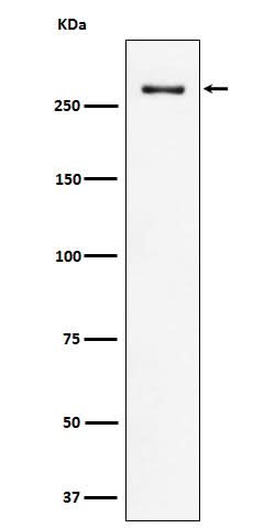 Anti-CHD3 Rabbit Monoclonal Antibody Boster Bio