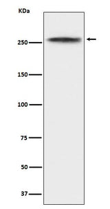 Anti-CHD3 Rabbit Monoclonal Antibody Boster Bio