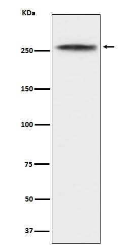 Anti-CHD3 Rabbit Monoclonal Antibody Boster Bio