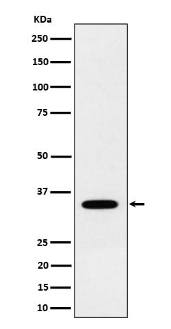 Anti-NTH1 Rabbit Monoclonal Antibody Boster Bio