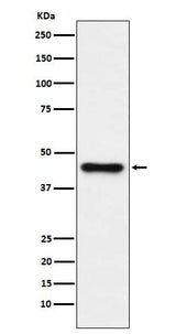 Anti-ABHD5 Monoclonal Antibody Boster Bio