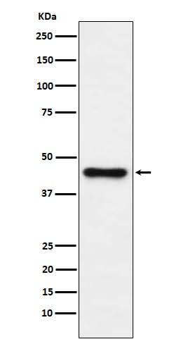 Anti-ABHD5 Monoclonal Antibody Boster Bio