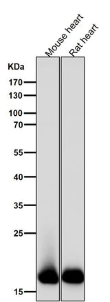 Anti-Myosin Light Chain 2 Rabbit Monoclonal Antibody Boster Bio
