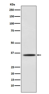 Anti-Myogenin Monoclonal Antibody Boster Bio