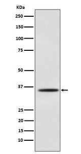 Anti-Myogenin Monoclonal Antibody Boster Bio